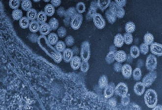中国发现H7N9禽流感新病例 病情危急