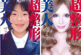 日本名模整容30多次 从丑女变身美女