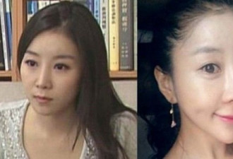 韩国女记者整容 被批下巴尖得可犁田