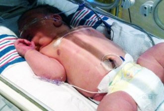 出生时重14.5磅 多伦多巨婴观察后出院