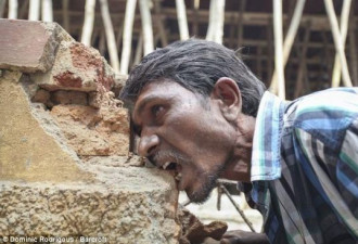 男子爱上吃砖石泥土 每天至少吃六斤