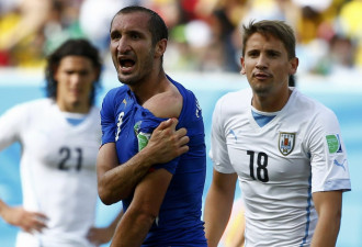 乌拉圭胜意大利出线 苏神咬人 牙印清晰