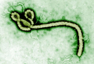 埃博拉病毒为何致命 去非洲旅游安全吗