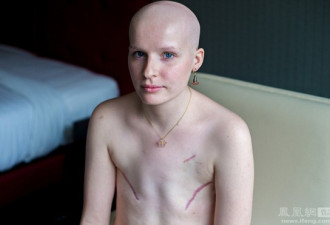 触目惊心 实拍：全球那些乳腺癌患者