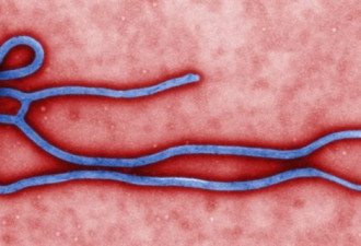 安省现2疑似伊博拉感染者 卫生部门紧张