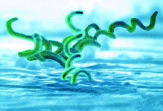 梅毒病例激增达41例 纽芬兰省拉响警报