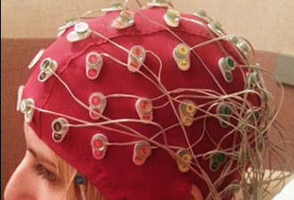 卑诗大学研究：化疗后化疗脑确实存在