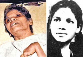 遭强奸勒颈成植物人42年 印度护士离世