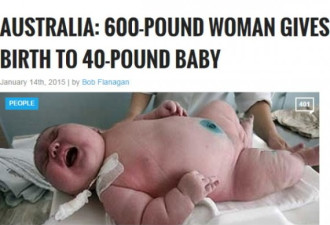 破了纪录!澳洲544斤女子诞下36斤巨婴