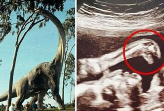准妈妈B超检查胎儿竟出现恐龙画面！