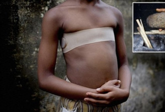 非洲少女把胸熨平防性侵 母亲亲动手