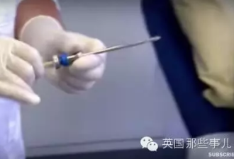 人肉是啥味 BBC记者从自己腿上挖了块