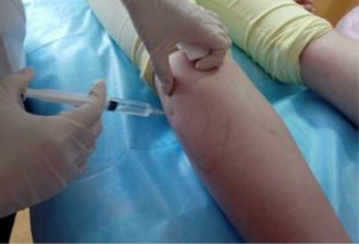 浙80后女子打瘦腿针 致全身肉毒素中毒险死