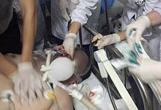 医生正做手术时 被患者家属用铁锤打后脑致死
