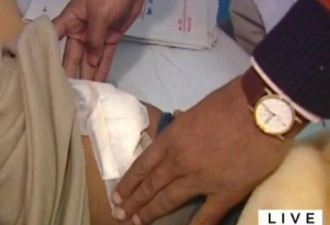 印度医院高价吸引穷人卖肾 转卖黑市牟利