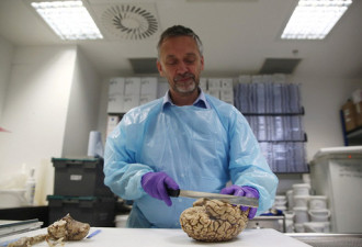 揭秘英国最大大脑银行 上千大脑样本被切片保存