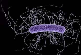 抗生素全然无效 纽约现全美第二例“超级细菌”