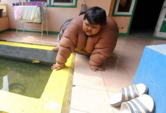 印尼10岁男童体重近200公斤 一日5餐食量惊人