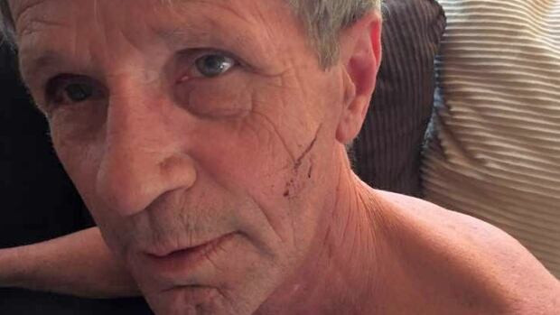 “You want to make sure if you punch a bear that you’re hitting it straight in its snout. That's really the only thing you have on a bear that will really startle it," Rick Nelson told CBC News.