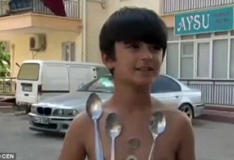土耳其男童成“小万磁王”自称身体能吸附金属