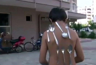 土耳其男童成“小万磁王”自称身体能吸附金属