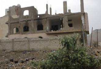 也门冲突不断 大批婴孩营养不良挤爆医院