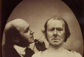 达尔文最后实验罕见旧照：电击穿脑看着都疼