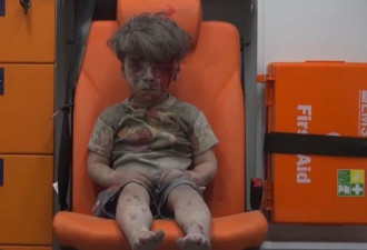 叙利亚空袭中5岁受伤男孩照片引发全球关注