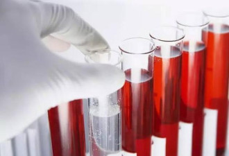 用干细胞研制“人工血液” 能解决“血荒”吗?