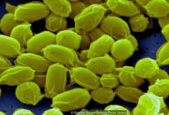 研究发现炭疽病菌最早由史前人类携带至全世界