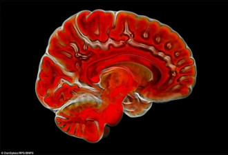 科学镜头下的不可思议之美：结构复杂的人脑