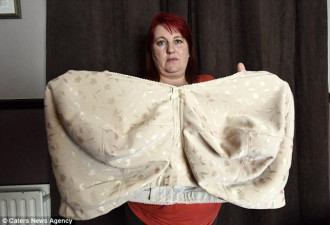 英国女子拥有20斤巨乳 胸罩需定制耗资上千