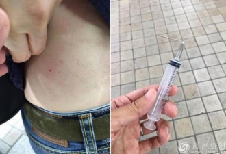恐怖经历！泰国游客在韩国被大妈用针管扎身体