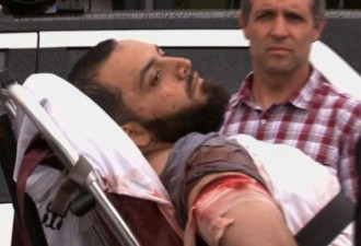 美国爆炸案嫌犯受伤落网 右臂受伤绑绷带