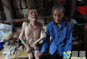 97岁母亲照顾瘫痪儿37年  医生曾说活不过5年