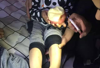 天津1所幼儿园教师疑似针扎辱骂恐吓儿童