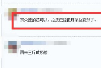 刘晓庆参加活动又年轻十岁 网友：耳朵拉变形了