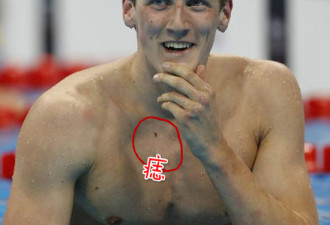 澳洲游泳选手霍顿手术除胸前痣 谢粉丝救命之恩