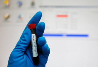 耶鲁大学新的验血方法 精准测出你还能活多久