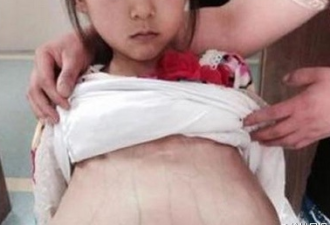 “徐州12岁怀孕女孩” 真实年龄身份曝光