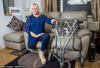 英国43岁女子刮腿毛后右腿溃烂 被迫截肢