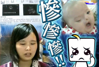 惨！深圳女婴无眼鼻耳 母亲8次产检未验出