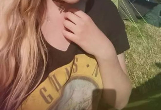 我太丑了！我活不下去了！ 20岁她3次尝试自杀