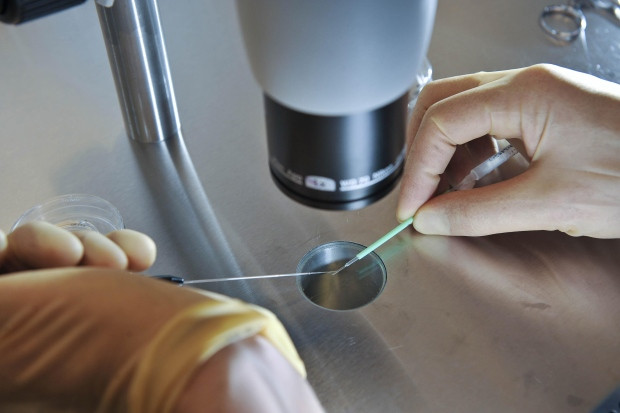 “Woman sues Toronto fertility clinic for loss of her eggs”的图片搜索结果