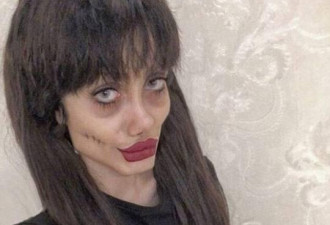 伊朗少女整容50次 变僵尸版安吉丽娜·朱莉