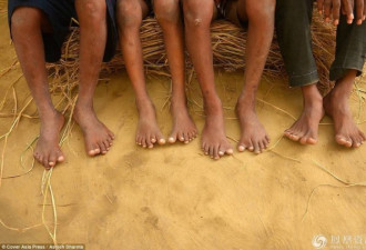 一个每人有12个手指和12个脚趾的“神奇家族”
