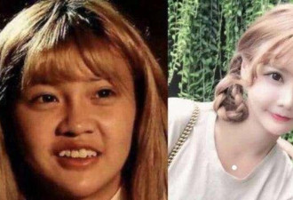 网红将进行第34次整容?要向更完美的自己出发