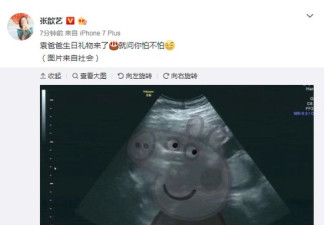 张歆艺晒B超照片宣布怀孕:给袁弘最好的礼物