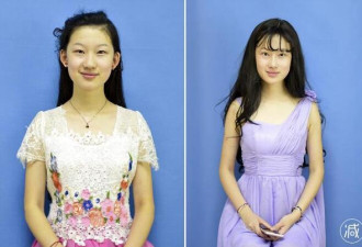 19岁女孩整容记：她要变脸“刘亦菲”