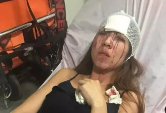 滴滴又出事 25岁女模特在北京坐快车惨被毁容